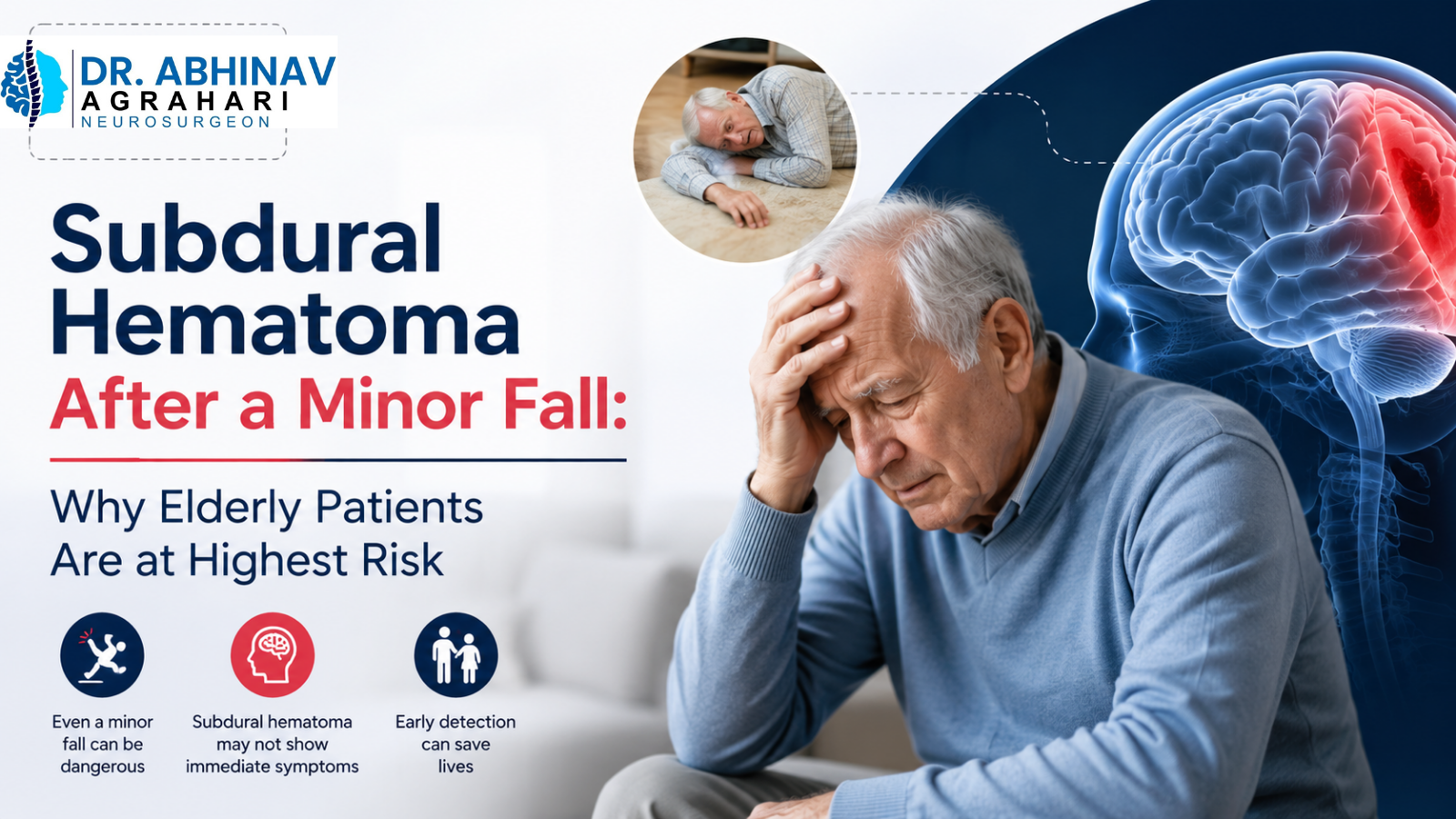 Subdural Hematoma After a Minor Fall: Why Elderly Patients Are at Highest Risk